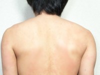 指や手で角栓を押し出すのは大丈夫 メンズスキンケア大学